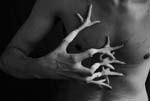 Stasys Eidrigevicius