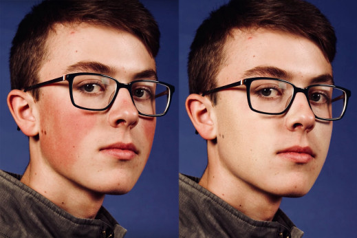 Photoshop w minutę. Dowiedz się jak łatwo usunąć zaczerwienienia cery na zdjęciach