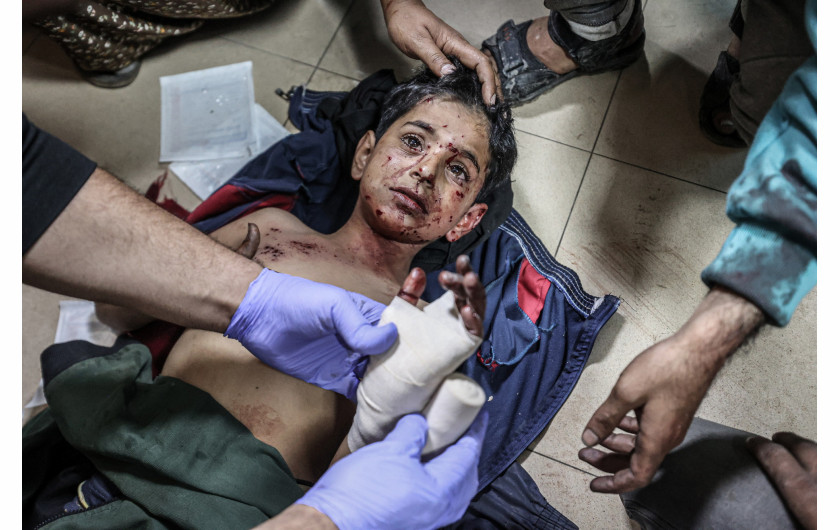 Z cyklu: Gaza Under Israeli Attack
fot. Ali Jadallah / Anadolu Agency / World Press Photo 2025




Izrael kontynuował wojnę w Strefie Gazy przez cały 2024 rok, pozostawiając znaczną część tego obszaru w ruinach. Według danych ONZ ponad 60% domów zostało zniszczonych, a 95% szpitali przestało funkcjonować. Prawie dwa miliony ludzi zostało przesiedlonych, zmagając się z dramatycznymi brakami żywności, czystej wody i leków, spowodowanymi izraelskimi restrykcjami.

Ponieważ międzynarodowi dziennikarze są de facto pozbawieni dostępu do Gazy, lokalni fotografowie ryzykują życie, dokumentując wojnę. Jeden z nich, który sam stracił bliskich, mówi: „Za każdym razem, gdy fotografuję zniszczony dom, myślę o swoim. Gdy spod gruzów wyciągani są ranni i zabici, przypominam sobie ojca i rodzeństwo”.
