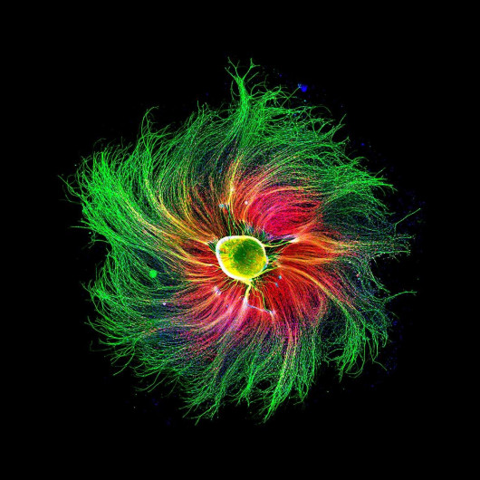 fot. Paula Diaz, 4. miejsce w konkursie Nikon's Small World 2021Neuron czuciowy w embrionie szczura