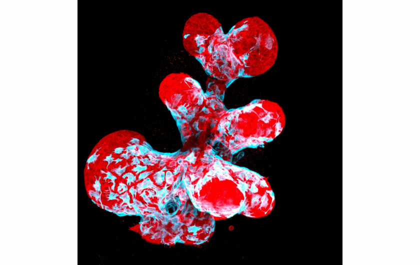 fot. Jakub Sumbal, 12. miejsce w konkursie Nikon's Small World 2021Organoid piersi przedstawiający kurczliwe komórki mioepitelialne (niebieski) pełzający po wydzielniczych komórkach piersi (czerwony)
