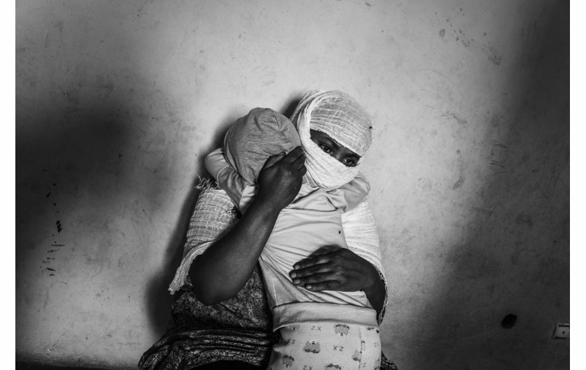 Z cyklu: Women's Bodies as Battlefields
fot. Cinzia Canneri / Association Camille Lepage / World Press Photo 2025



W 2017 roku Cinzia Canneri rozpoczęła dokumentowanie doświadczeń Erytrejek uciekających przed represyjnym reżimem swojego kraju. Po wybuchu wojny w regionie Tigraj w północnej Etiopii w 2020 roku, jej projekt rozszerzył się o historie kobiet z Tigraju, które zmuszone były opuścić swoje domy w wyniku zbrojnej inwazji. Obie grupy stały się celem systematycznej przemocy seksualnej – gwałtów, postrzałów, tortur – o której, z powodu społecznego tabu, ograniczonego dostępu do opieki zdrowotnej i trudności w dotarciu do ofiar, media informują zbyt rzadko. Ukazując historie i głosy ocalałych, projekt ten na nowo definiuje pojęcie odporności – jako złożonego, zbiorowego wysiłku w walce z bólem, traumą i stratą.