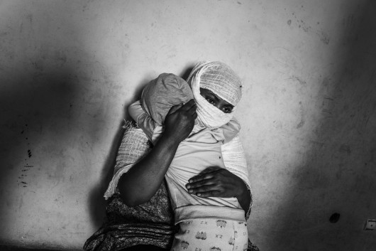 Z cyklu: Women's Bodies as Battlefields
fot. Cinzia Canneri / Association Camille Lepage / World Press Photo 2025



W 2017 roku Cinzia Canneri rozpoczęła dokumentowanie doświadczeń Erytrejek uciekających przed represyjnym reżimem swojego kraju. Po wybuchu wojny w regionie Tigraj w północnej Etiopii w 2020 roku, jej projekt rozszerzył się o historie kobiet z Tigraju, które zmuszone były opuścić swoje domy w wyniku zbrojnej inwazji. Obie grupy stały się celem systematycznej przemocy seksualnej – gwałtów, postrzałów, tortur – o której, z powodu społecznego tabu, ograniczonego dostępu do opieki zdrowotnej i trudności w dotarciu do ofiar, media informują zbyt rzadko. Ukazując historie i głosy ocalałych, projekt ten na nowo definiuje pojęcie odporności – jako złożonego, zbiorowego wysiłku w walce z bólem, traumą i stratą.