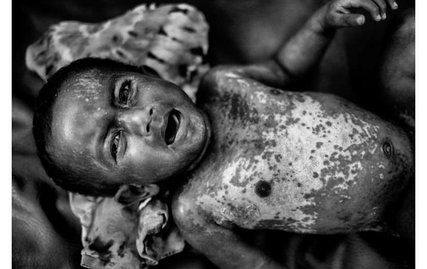 fot. Mushafiqul Alam, z cyklu The Great Exodus: People With No Land, druga nagroda w konkursie PX3 Prix de la Photographie, Paris 2018
