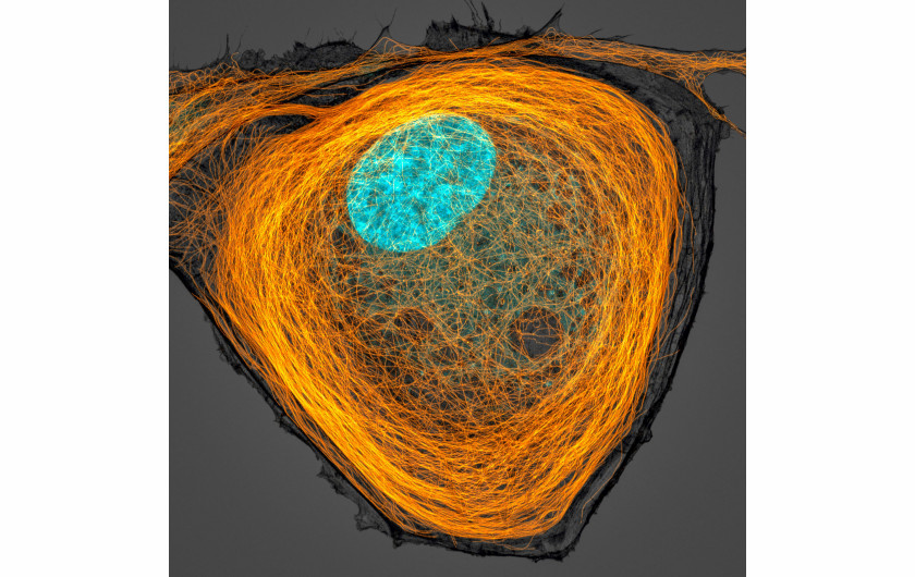 fot. Jason Kirk, mikrotubule wewnątrz komórki (na pomarańczowo), 7. miejsce w konkursie Nikon's Small World 2020