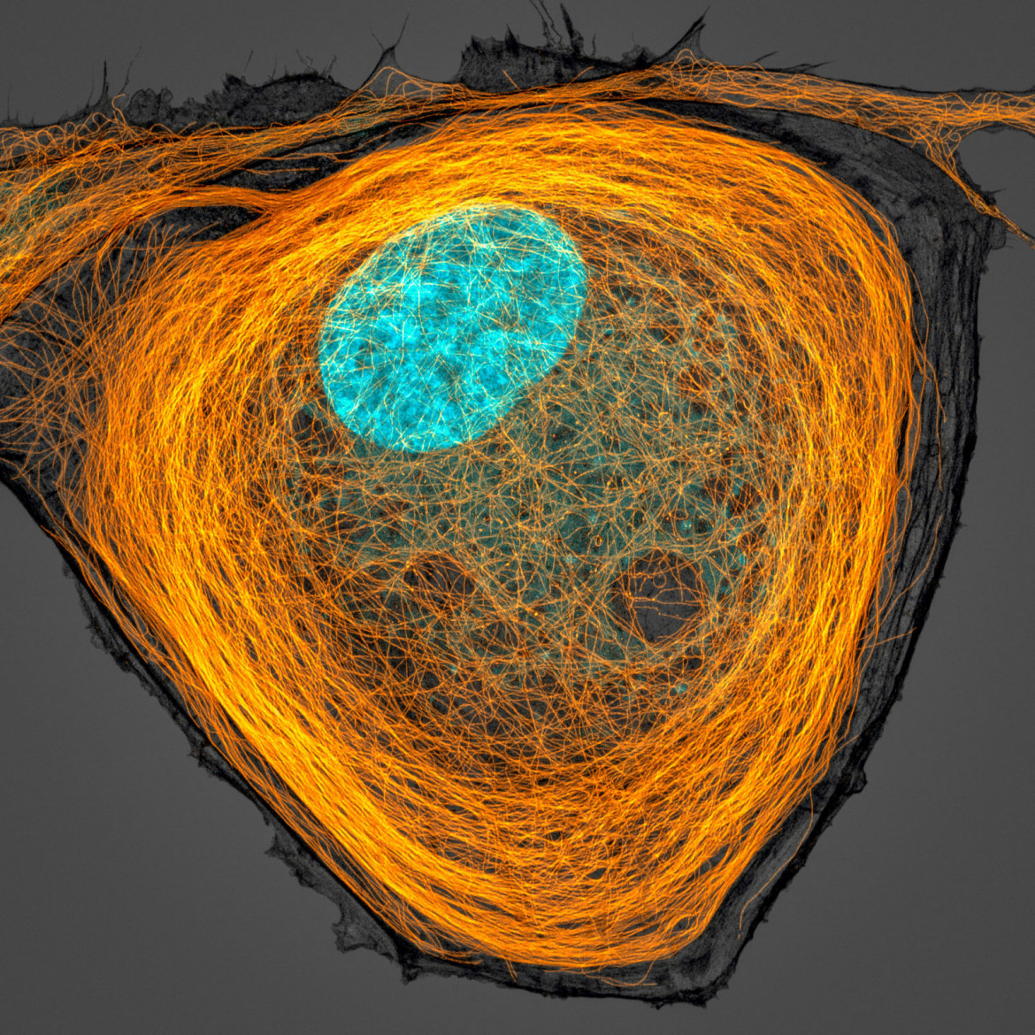 fot. Jason Kirk, mikrotubule wewnątrz komórki (na pomarańczowo), 7. miejsce w konkursie Nikon's Small World 2020