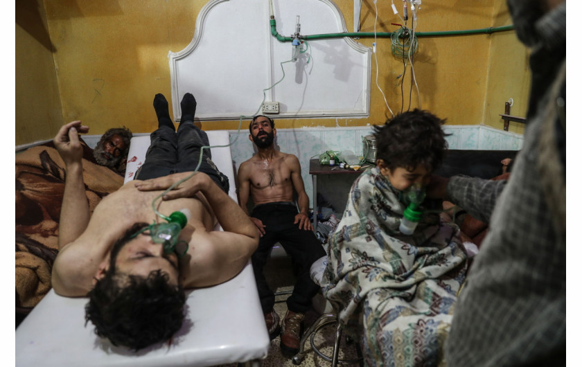 fot. Mohammed Badra, European Pressphoto Agency, Syria, No Exit, 2. miejsce w kategorii Spot News.

Mieszkańcy wschodniej Ghouty, podmiejskiej dzielnicy Damaszku i jednego z ostatnich bastionów syryjskich rebeliantów od 5 lat są pod oblężeniem sił rządowych. Podczas ostatniej ofensywy Ghouta stała się celem bombardowań i przynajmniej jednego ataku z użyciem gazu. Szacuje się, że między 18 lutego, a 3 marca 2018 roku zginęło 1005 osób, a 4829 zostało rannych. Zniszczono też 13 szpitali i klinik. Na zdjęciu cywile otrzymujący wparcie po domniemanym ataku z użyciem gazu bojowego. 25.02.2018