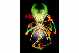 fot. Dr. Dorit Hockma, Dr. Vanessa Chong-Morrison, szkielet embrionu nietoperza owocowego, 20. miejsce w konkursie Nikon's Small World 2020