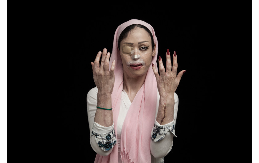 nagroda L’Iris d’Or, tytuł Fotografa Roku, kategoria Contemporary Issues, I miejsce, fot. Asghar Khamseh (Iran)