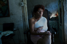 fot. Oded Wagenstein, Ilama Bural Morachon, Cienfuegos, Kuba, Grudzień 2016. Po poślizgnięciu się, złamaniu ręki i barku, musi mieć nieustanną pomoc. "Ciało cię zdradza. To straszne uczucie", powiedziała mi.